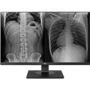 Monitor IPS LED LG 27inch 27U730A-B,HD (3840 x 2160), HDMI, DisplayPort, Boxe, Pivot (Negru) Monitor IPS LED LG 27inch 27U730A-B,HD (3840 x 2160), HDMI, DisplayPort, Boxe, Pivot (Negru)